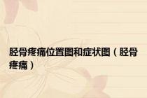 胫骨疼痛位置图和症状图（胫骨疼痛）