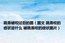 跳蚤被咬过后的图（图文 跳蚤咬的症状是什么 被跳蚤咬的症状图片）