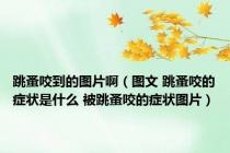 跳蚤咬到的图片啊（图文 跳蚤咬的症状是什么 被跳蚤咬的症状图片）
