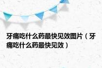 牙痛吃什么药最快见效图片（牙痛吃什么药最快见效）