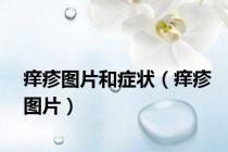 痒疹图片和症状（痒疹图片）