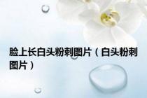 脸上长白头粉刺图片（白头粉刺图片）