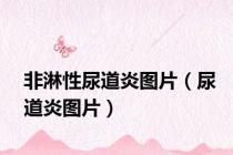 非淋性尿道炎图片（尿道炎图片）