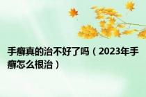 手癣真的治不好了吗（2023年手癣怎么根治）