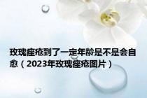 玫瑰痤疮到了一定年龄是不是会自愈（2023年玫瑰痤疮图片）