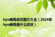 hpv病毒症状图片大全（2024年hpv病毒是什么症状）