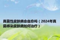 真菌性皮肤病会自愈吗（2024年真菌感染皮肤病如何治疗）