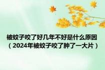 被蚊子咬了好几年不好是什么原因（2024年被蚊子咬了肿了一大片）