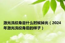 激光洗纹身是什么时候掉光（2024年激光洗纹身后的样子）