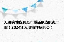 无肌病性皮肌炎严重还是皮肌炎严重（2024年无肌病性皮肌炎）