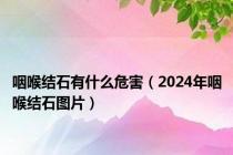 咽喉结石有什么危害（2024年咽喉结石图片）