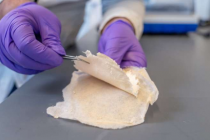 纳米纤维涂层棉绷带可抵抗感染并加速愈合