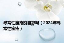 寻常性痤疮能自愈吗（2024年寻常性痤疮）