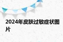2024年皮肤过敏症状图片