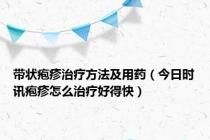 带状疱疹治疗方法及用药（今日时讯疱疹怎么治疗好得快）