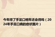 今年得了手足口明年还会得吗（2024年手足口病的症状图片）