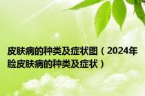 皮肤病的种类及症状图（2024年脸皮肤病的种类及症状）