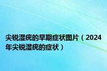 尖锐湿疣的早期症状图片（2024年尖锐湿疣的症状）