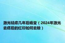 激光祛痣几年后癌变（2024年激光去痣后的红印如何去除）
